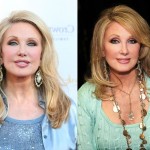 Morgan Fairchild before and after plastic surgery 07