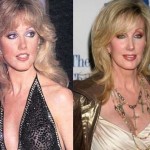 Morgan Fairchild before and after plastic surgery 08