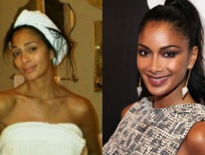 Nicole Scherzinger before and after plastic surgery