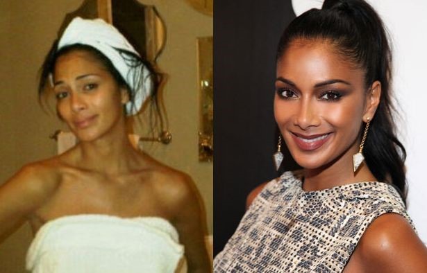Nicole Scherzinger before and after plastic surgery