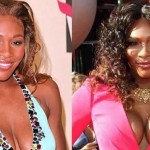 Serena Williams before and after plastic surgery 05