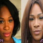 Serena Williams before and after plastic surgery 06