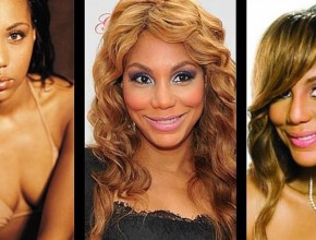 Tamar Braxton before and after plastic surgery