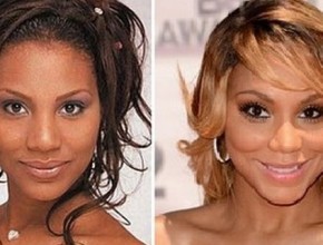 Tamar Braxton before and after plastic surgery 01