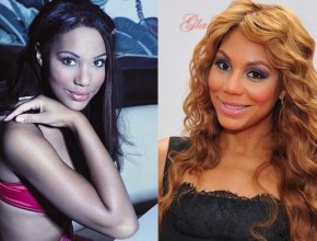 Tamar Braxton before and after plastic surgery