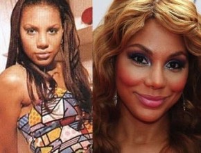 Tamar Braxton before and after plastic surgery 04