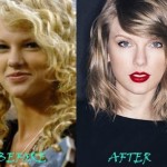 Taylor Swift before and after plastic surgery 01