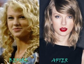 Taylor Swift before and after plastic surgery 01