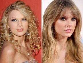 Taylor Swift before and after plastic surgery