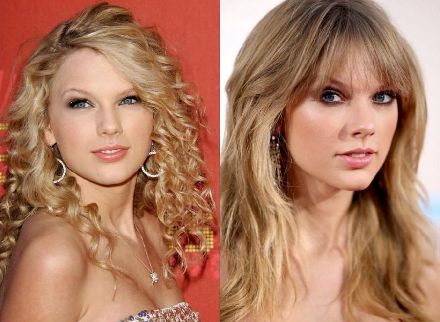 Taylor Swift before and after plastic surgery