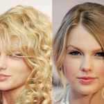 Taylor Swift before and after plastic surgery 03