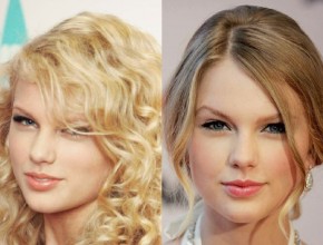 Taylor Swift before and after plastic surgery 03