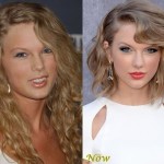 Taylor Swift before and after plastic surgery 04