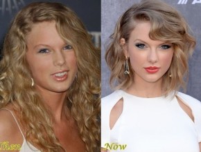 Taylor Swift before and after plastic surgery 04