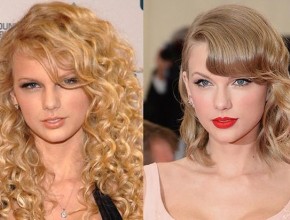 Taylor Swift before and after plastic surgery 05