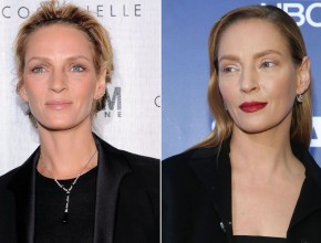 Uma Thurman before and after plastic surgery