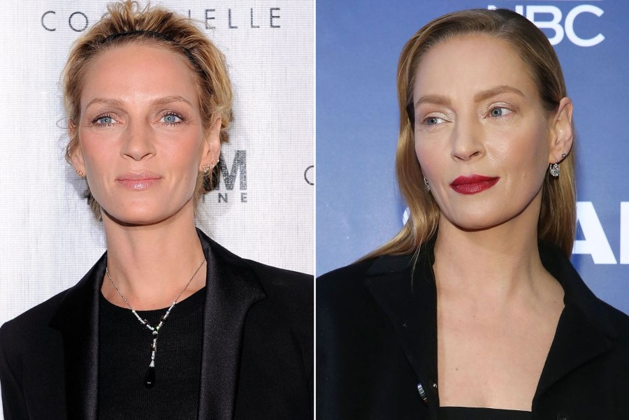 Uma Thurman before and after plastic surgery