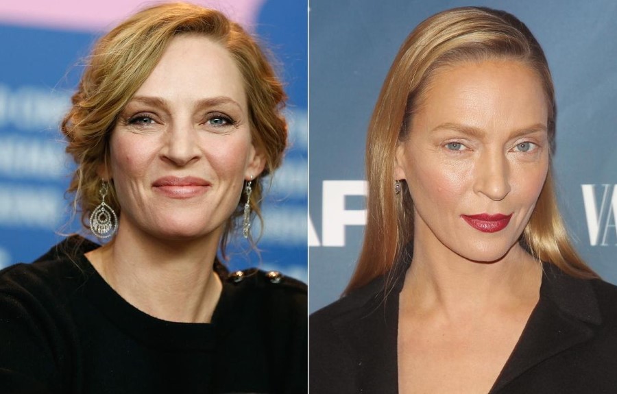 Uma Thurman before and after plastic surgery