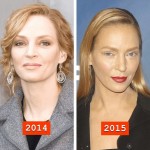 Uma Thurman before and after plastic surgery 03