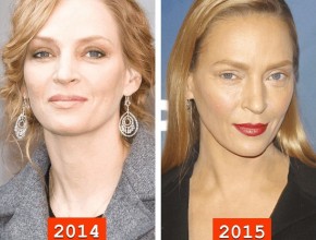 Uma Thurman before and after plastic surgery 03