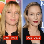 Uma Thurman before and after plastic surgery 04