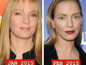 Uma Thurman before and after plastic surgery 04