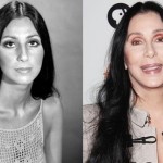 Cher before and after plastic surgery 02