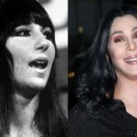 Cher before and after plastic surgery 03