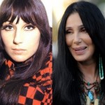 Cher before and after plastic surgery