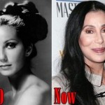 Cher before and after plastic surgery