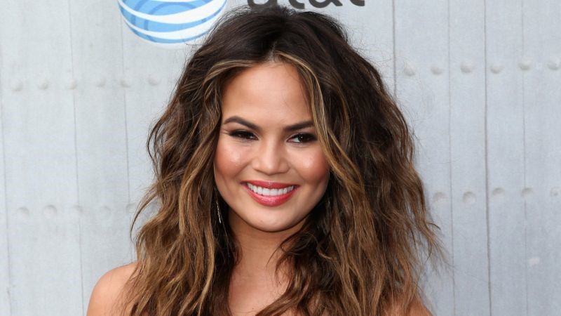 Chrissy Teigen plastic surgery