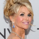 Christie Brinkley after brow lift