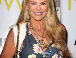 Christie Brinkley after plastic surgery 01
