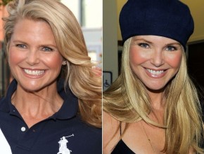 Christie Brinkley before and after plastic surgery