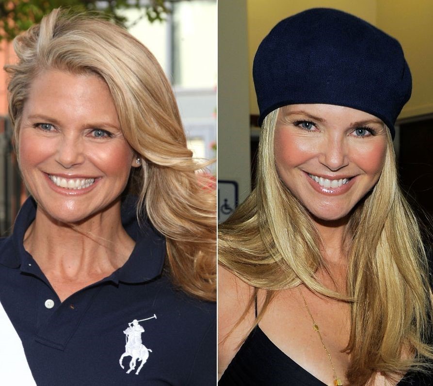 Christie Brinkley before and after plastic surgery
