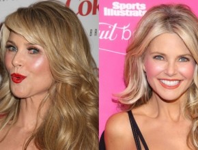 Christie Brinkley before and after plastic surgery 02