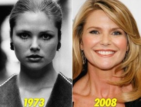 Christie Brinkley before and after plastic surgery