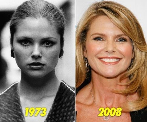 Christie Brinkley before and after plastic surgery