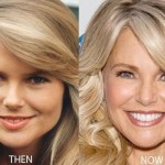 Christie Brinkley before and after plastic surgery 04