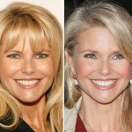 Christie Brinkley before and after plastic surgery 07