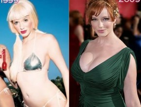 Christina Rene Hendricks before and after plastic surgery 02