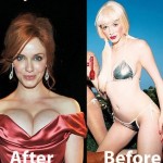 Christina Rene Hendricks before and after plastic surgery