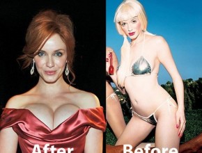 Christina Rene Hendricks before and after plastic surgery