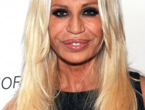 Donatella Versace after plastic surgery and Botox inections