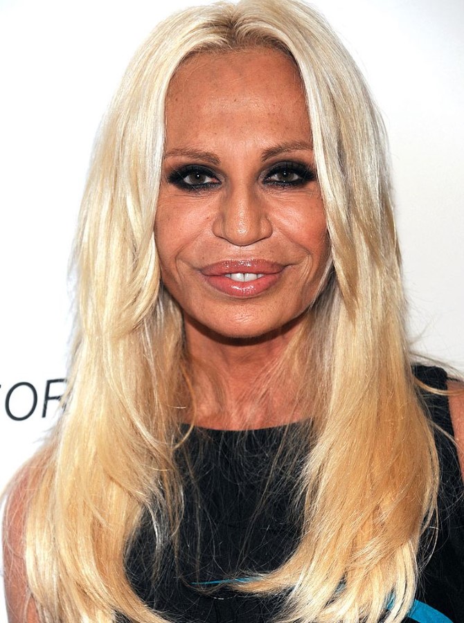 Donatella Versace after plastic surgery and Botox inections – Celebrity ...