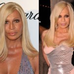 Donatella Versace before and after plastic surgery 08