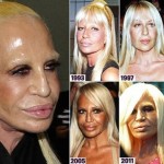 Donatella Versace plastic surgery transformations 02