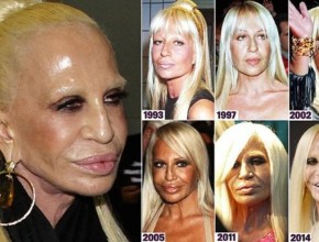 Donatella Versace plastic surgery transformations 02