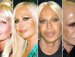 Donatella Versace plastic surgery transformations
