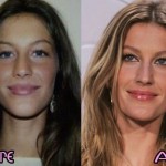 Gisele Bundchen before and after plastic surgery